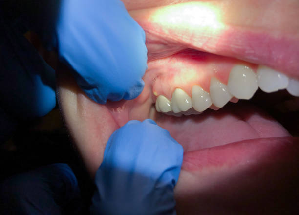 Best Urgent Care for Lost Fillings or Crowns in Ara, AL